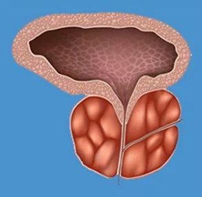Die charakteristischen Merkmale der Prostatitis