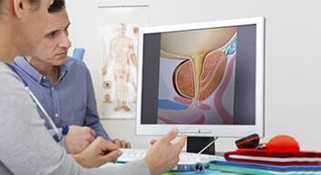 Diagnose von Prostatitis bei einem Mann