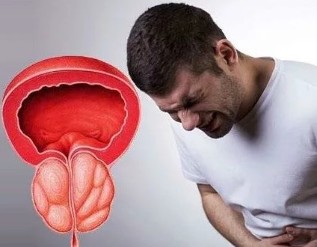 Symptome der chronischen Prostatitis bei Männern